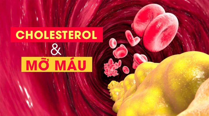 Hành trình sống khỏe: Kiểm soát cholesterol, làm chủ cuộc đời